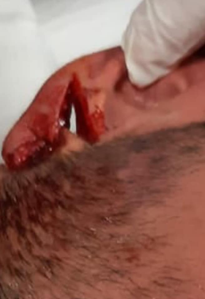 Feroz agresión en una Liga del interior cordobés: un jugador mordió en la oreja a un rival, terminó en el hospital | Canal Showsport