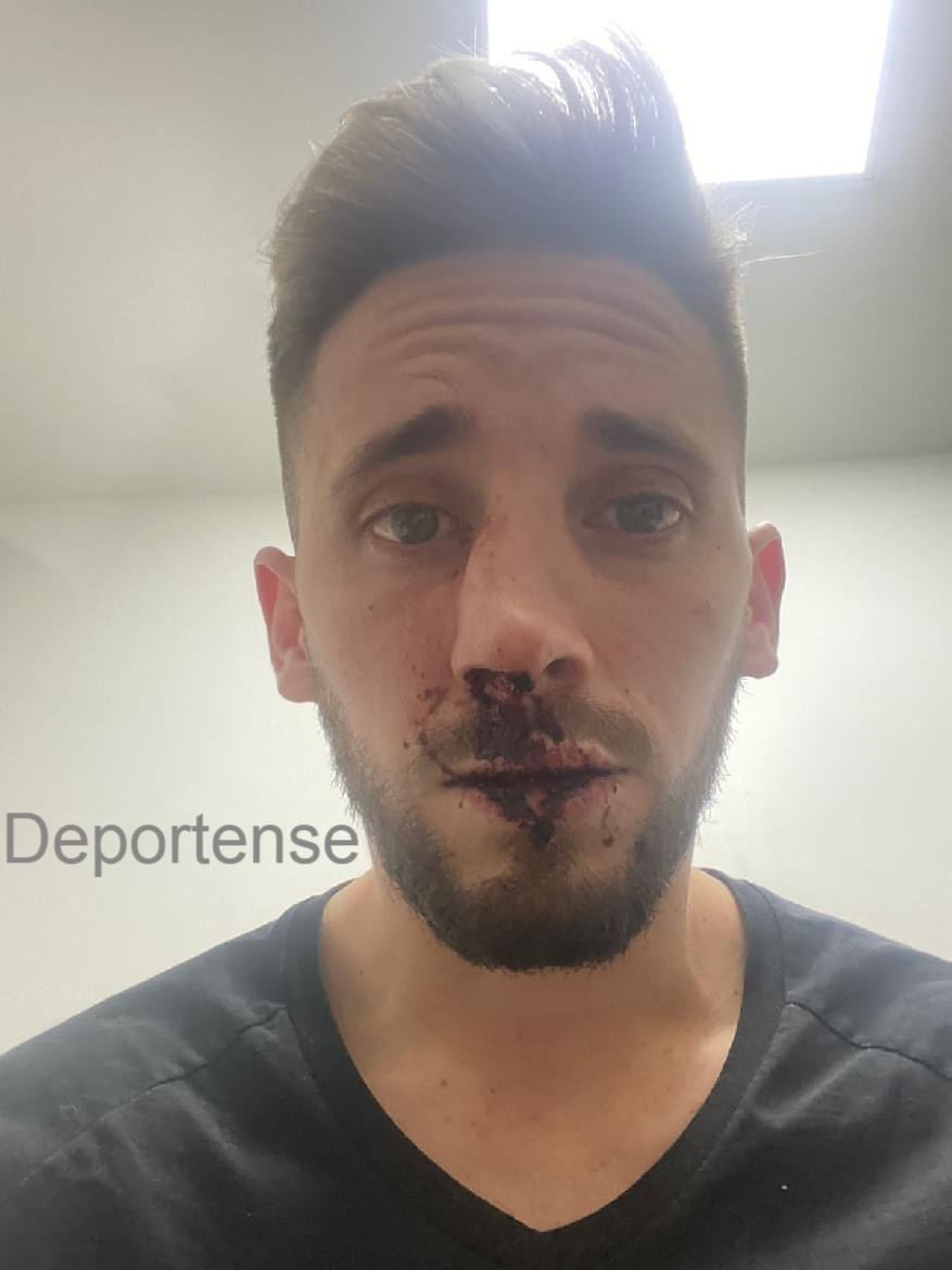 Violencia en el fútbol argentino: Nicolás Morgantini, defensor de Platense, fue agredido salvajemente | Canal Showsport